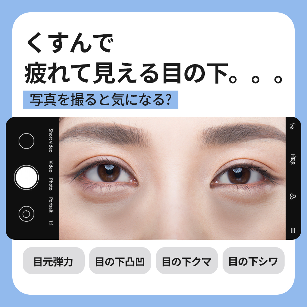くすんで疲れて見える目の下。。。